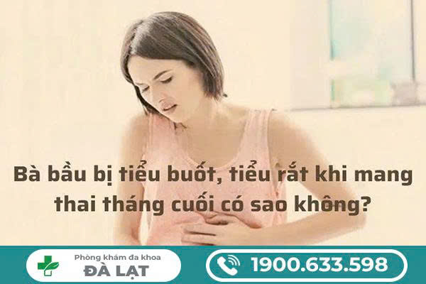 Hình ảnh minh họa